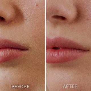 Facial Hair Remover