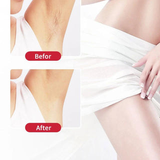 Facial Hair Remover